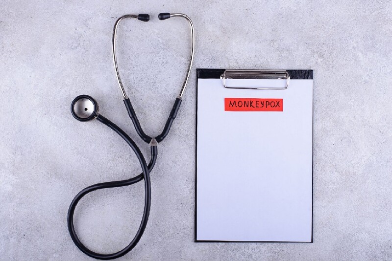 A medical chart lists "Monkeypox," with a stethoscope beside it. Stock Photo